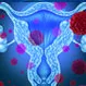 What Does Uterine Cancer Pain Feel Like?