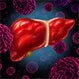 Liver Cancer