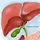 Primary Biliary Cirrhosis (PBC) Treatment