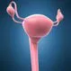 How Do You Fix a Prolapsed Uterus?