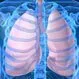 Pulmonary Edema