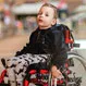 Is Spinal Muscular Atrophy Treatable?