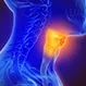 What Are Laryngeal and Hypopharyngeal Cancers?