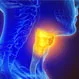 How Do You Know if You Have HPV in Your Throat?