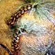 Picture of Traction Alopecia