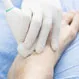 How Do You Treat Tendonitis in the Ankle?