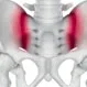 What Causes Sacroiliitis and Is It Serious?