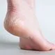 Ankle Pain (Tendonitis)