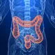 Colon Cancer Prevention