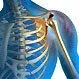 Shoulder Bursitis