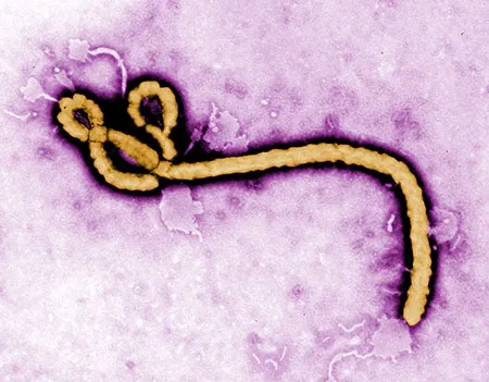 Picture of the Ebola virus, viewed with an electron microscope