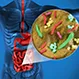 What Is the Main Cause of Leaky Gut, and How Do You Fix It?