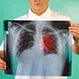 Lung Cancer Quiz: Signs and Symptoms