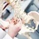 Osteoporosis Quiz: What is Osteoporosis?