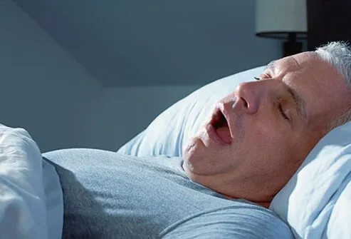 Sleep apnea is a serious sleep disorder in which sufferers briefly stop breathing for short periods during sleep.