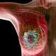 Breast Cancer Awareness: Symptoms, Diagnosis, and Treatment