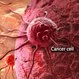 Understanding Cancer: Metastasis, Stages of Cancer, and More