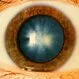 Cataracts Causes, Symptoms, Vision Tests, and Surgery