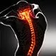 Back Pain: Common Spine Problems