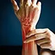 Arthritis: Causes and Treatment for Joint Stiffness and Pain