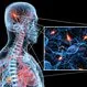 What Is Multiple Sclerosis? MS Symptoms, Causes, Diagnosis