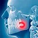 Why We Have Wisdom Teeth: Surgery, Pain, and Treatment