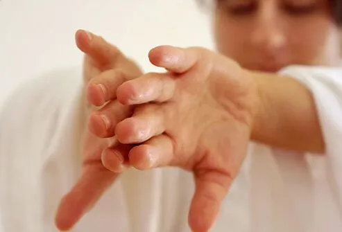 Qigong for fibromyalgia muscle pain.