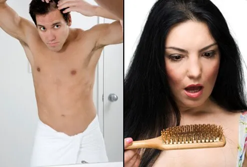 Hair loss in men and women