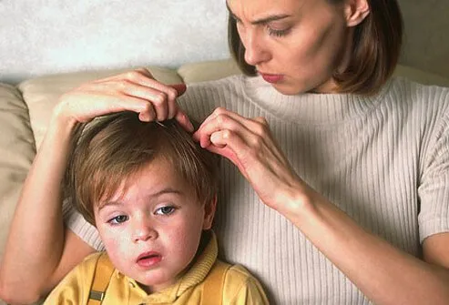 Unfortunately, it is next to impossible to prevent all head lice infestations.