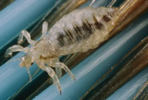 Lice spread through direct contact.