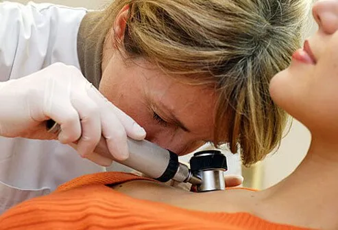 Dermatologist checking mole for melanoma