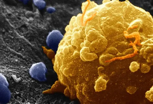 Scanning electron micrograph of a melanoma cell