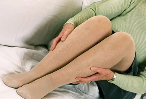 Support stockings, also called compression stockings, are an easy intervention to use at home to help alleviate symptoms in your legs.