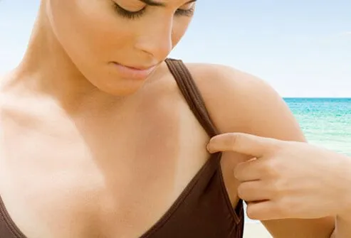 Darkened skin that results from tanning is actually a sign of damage to the skin.