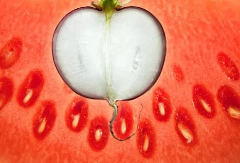 Photo of watermelon and radish.