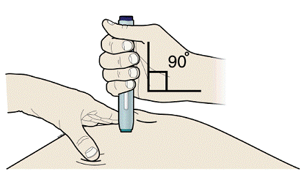 Pinch method - Illustration