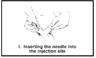 Attach the needle to the syringe - Illustration