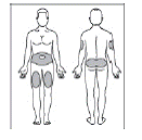 Choose your injection site - Illustration