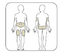 The <b>odd</b> numbers, (for example, 25) after
        the number 1, are shown as full lines.
        (Example: 12 units shown
        in the Dose Window)- Illustration