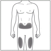 Choose your injection site Illustration