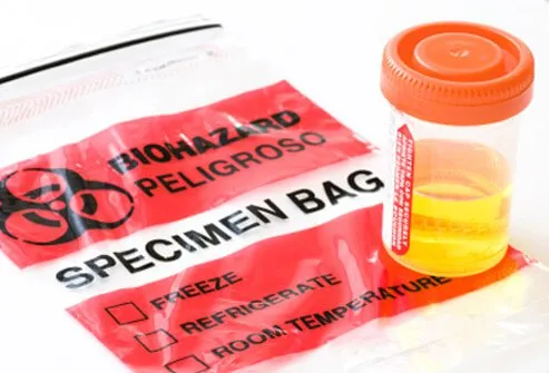 A patient may be asked to provide a urine and stool sample.