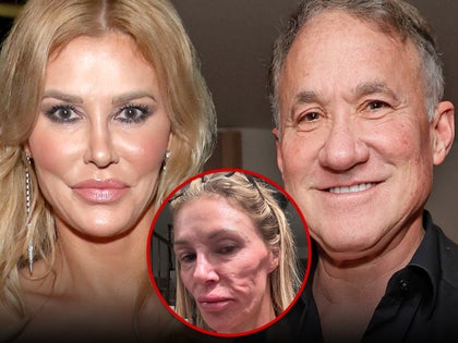 brandi glanville terry dubrow dissolved face fillers getty x