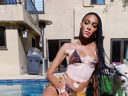 winnie-harlow-quarantine-hot-photos13