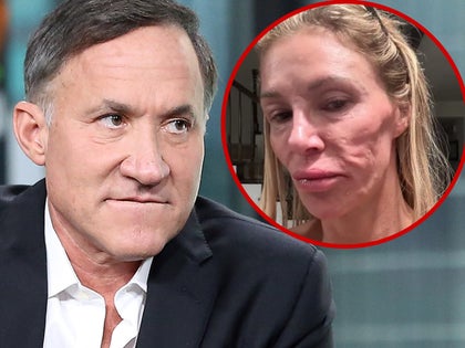 terry dubrow brandi glanville's messed up face