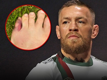 conor mcgregor injury getty twitter 1