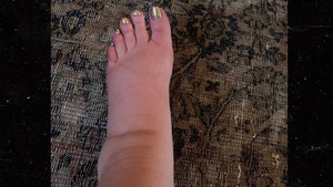 0111_Jessica-Simpson_swollen-leg-twitter