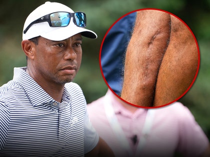 TIGER WOODS LEG SCAR