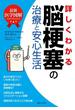 最新医学図解　詳しくわかる脳梗塞の治療と安心生活