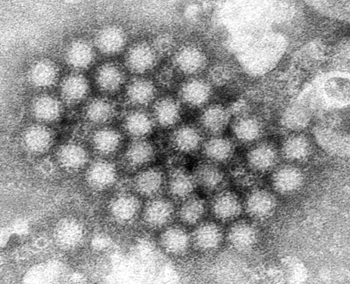 ARCHIVO - Esta imagen de microscopio electrónico facilitada por los Centros para el Control y la Prevención de Enfermedades de Estados Unidos (CDC, por sus siglas en inglés) muestra un grupo de viriones de norovirus. (Charles D. Humphrey/CDC vía AP, Archivo)