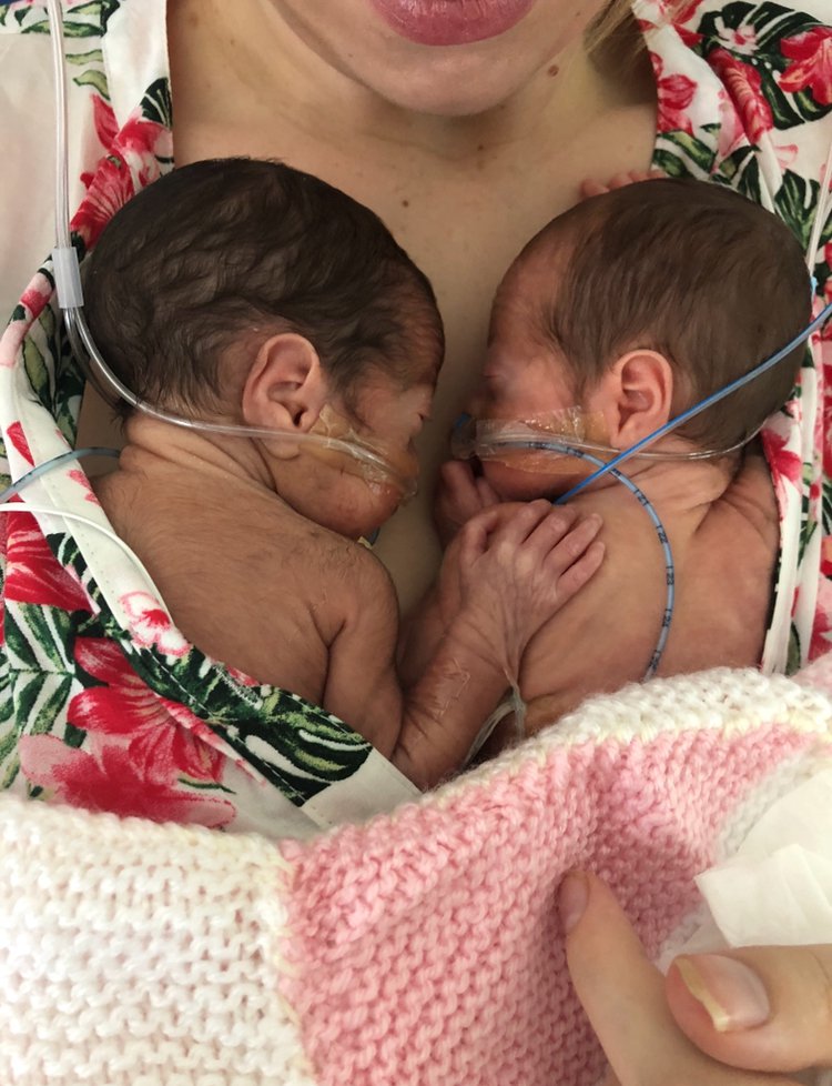 Ella-Mae Michaelski and twins Bella & Ruby Rainbow Trust i Christmas Appeal 2021 Image via anna.jackson@rainbowtrust.org.uk